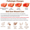 LMNOOP® Bed Sore Ointment, Maximum Strength Wound Care Cream for Infection Protection & Skin Repair, Fast Healing for Diabetic Wounds, Pressure Sores, Venous Ulcer, Burns, Cuts, Scrapes
