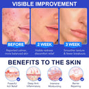 Folliculitis Treatment Cream, Fast Acting & Soothing for Folliculitis Scalp, Clogged Pores, Bumps, Excess Oil, for Face & Body|100g
