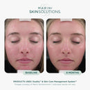 Marini SkinSolutions Duality - Benzoyl Peroxide 10% Acne Treatment Cream & Anti-Aging Retinol - Reduce the Appearance of Acne, Blemishes, Fine Lines, Wrinkles - Cruelty Free - Made in the USA - 1 oz
