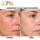 Beef Tallow Sunscreen for Face & Body- Natural Mineral Sunscreen SPF 50 - With Grass-Fed Tallow & Non-Nano Zinc Oxide Reef Safe