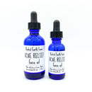 Acne Relief Face Oil