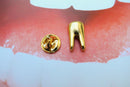 Tooth Gold Lapel Pin
