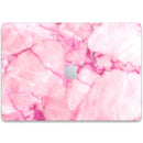 MacBook Pro 13 Touchbar (2016) Marble Series Skins